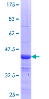 CCDC115 Protein - 12.5% SDS-PAGE of human MGC12981 stained with Coomassie Blue