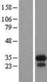 CCDC117 Protein - Western validation with an anti-DDK antibody * L: Control HEK293 lysate R: Over-expression lysate