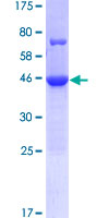 CCDC117 Protein - 12.5% SDS-PAGE of human CCDC117 stained with Coomassie Blue