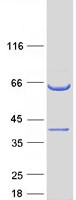 CCDC117 Protein - Purified recombinant protein CCDC117 was analyzed by SDS-PAGE gel and Coomassie Blue Staining