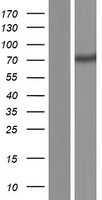 CCDC120 Protein - Western validation with an anti-DDK antibody * L: Control HEK293 lysate R: Over-expression lysate