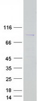 CCDC120 Protein - Purified recombinant protein CCDC120 was analyzed by SDS-PAGE gel and Coomassie Blue Staining
