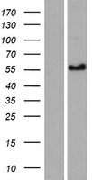 CCDC125 Protein - Western validation with an anti-DDK antibody * L: Control HEK293 lysate R: Over-expression lysate