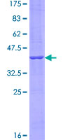 CCDC126 Protein - 12.5% SDS-PAGE of human CCDC126 stained with Coomassie Blue