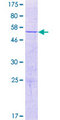 CCDC127 Protein - 12.5% SDS-PAGE of human CCDC127 stained with Coomassie Blue