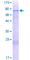 CCDC130 Protein - 12.5% SDS-PAGE of human CCDC130 stained with Coomassie Blue