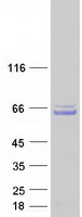CCDC130 Protein - Purified recombinant protein CCDC130 was analyzed by SDS-PAGE gel and Coomassie Blue Staining