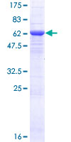 CCDC132 Protein - 12.5% SDS-PAGE of human CCDC132 stained with Coomassie Blue