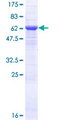 CCDC132 Protein - 12.5% SDS-PAGE of human CCDC132 stained with Coomassie Blue