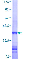 CCDC132 Protein - 12.5% SDS-PAGE Stained with Coomassie Blue.