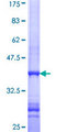 CCDC132 Protein - 12.5% SDS-PAGE Stained with Coomassie Blue.