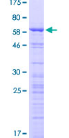 CCDC137 Protein - 12.5% SDS-PAGE of human CCDC137 stained with Coomassie Blue