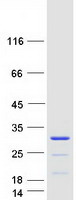 CCDC140 Protein - Purified recombinant protein CCDC140 was analyzed by SDS-PAGE gel and Coomassie Blue Staining
