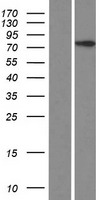 CCDC142 Protein - Western validation with an anti-DDK antibody * L: Control HEK293 lysate R: Over-expression lysate
