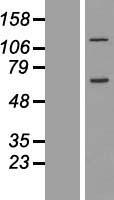 CCDC146 Protein - Western validation with an anti-DDK antibody * L: Control HEK293 lysate R: Over-expression lysate