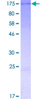 CCDC146 Protein - 12.5% SDS-PAGE of human CCDC146 stained with Coomassie Blue