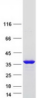 CCDC149 Protein - Purified recombinant protein CCDC149 was analyzed by SDS-PAGE gel and Coomassie Blue Staining