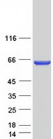 CCDC149 Protein - Purified recombinant protein CCDC149 was analyzed by SDS-PAGE gel and Coomassie Blue Staining