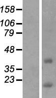 CCDC153 Protein - Western validation with an anti-DDK antibody * L: Control HEK293 lysate R: Over-expression lysate