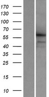 CCDC155 Protein - Western validation with an anti-DDK antibody * L: Control HEK293 lysate R: Over-expression lysate