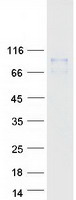 CCDC157 Protein - Purified recombinant protein CCDC157 was analyzed by SDS-PAGE gel and Coomassie Blue Staining
