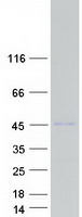 CCDC159 Protein - Purified recombinant protein CCDC159 was analyzed by SDS-PAGE gel and Coomassie Blue Staining