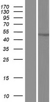 CCDC169-SOHLH2 Protein - Western validation with an anti-DDK antibody * L: Control HEK293 lysate R: Over-expression lysate