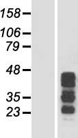CCDC17 Protein - Western validation with an anti-DDK antibody * L: Control HEK293 lysate R: Over-expression lysate