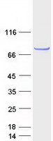 CCDC170 / C6orf97 Protein - Purified recombinant protein CCDC170 was analyzed by SDS-PAGE gel and Coomassie Blue Staining