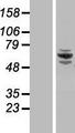 CCDC22 Protein - Western validation with an anti-DDK antibody * L: Control HEK293 lysate R: Over-expression lysate