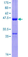 CCDC28A Protein - 12.5% SDS-PAGE of human CCDC28A stained with Coomassie Blue