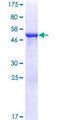 CCDC28B Protein - 12.5% SDS-PAGE of human CCDC28B stained with Coomassie Blue