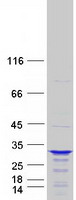CCDC28B Protein - Purified recombinant protein CCDC28B was analyzed by SDS-PAGE gel and Coomassie Blue Staining