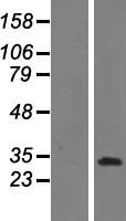 CCDC3 Protein - Western validation with an anti-DDK antibody * L: Control HEK293 lysate R: Over-expression lysate
