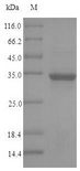 CCDC3 Protein - (Tris-Glycine gel) Discontinuous SDS-PAGE (reduced) with 5% enrichment gel and 15% separation gel.