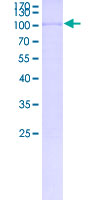 CCDC36 Protein - 12.5% SDS-PAGE of human CCDC36 stained with Coomassie Blue