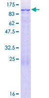 CCDC40 Protein - 12.5% SDS-PAGE of human CCDC40 stained with Coomassie Blue