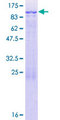 CCDC40 Protein - 12.5% SDS-PAGE of human CCDC40 stained with Coomassie Blue