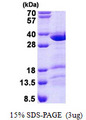 CCDC43 Protein