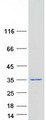 CCDC43 Protein - Purified recombinant protein CCDC43 was analyzed by SDS-PAGE gel and Coomassie Blue Staining