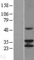CCDC44 / TACO1 Protein - Western validation with an anti-DDK antibody * L: Control HEK293 lysate R: Over-expression lysate