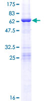 CCDC44 / TACO1 Protein - 12.5% SDS-PAGE of human CCDC44 stained with Coomassie Blue