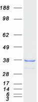 CCDC44 / TACO1 Protein - Purified recombinant protein TACO1 was analyzed by SDS-PAGE gel and Coomassie Blue Staining