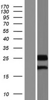CCDC46 Protein - Western validation with an anti-DDK antibody * L: Control HEK293 lysate R: Over-expression lysate