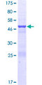 CCDC46 Protein - 12.5% SDS-PAGE of human CEP112 stained with Coomassie Blue
