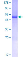 CCDC53 Protein - 12.5% SDS-PAGE of human CCDC53 stained with Coomassie Blue