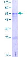 CCDC54 Protein - 12.5% SDS-PAGE of human CCDC54 stained with Coomassie Blue