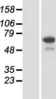 CCDC55 Protein - Western validation with an anti-DDK antibody * L: Control HEK293 lysate R: Over-expression lysate
