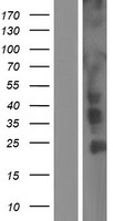 CCDC6 Protein - Western validation with an anti-DDK antibody * L: Control HEK293 lysate R: Over-expression lysate