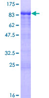 CCDC6 Protein - 12.5% SDS-PAGE of human CCDC6 stained with Coomassie Blue